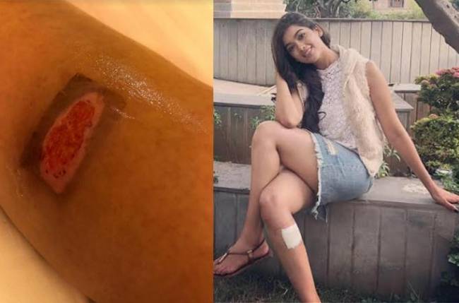 Digangana injures herself while shooting for her film